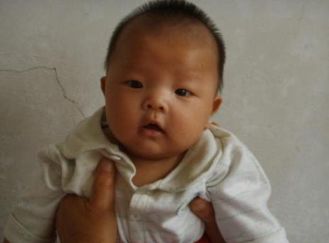 三个月小宝宝斗鸡眼能治好吗,三个月的宝宝斗鸡眼怎么回事