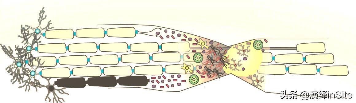 脊髓损伤将不再是不治之症,脊髓损伤手不能动能治愈吗