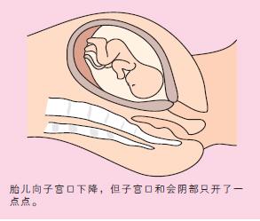 宝宝顺产出生的过程,剖腹产的小孩比顺产的小孩胆小吗