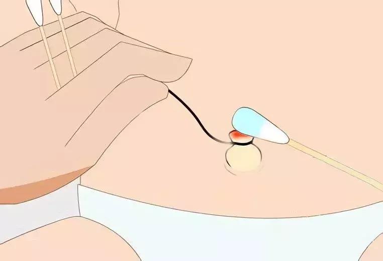 新生儿脐部护理及常见问题处理,新生儿脐部的护理方法