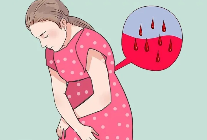 子宫异常出血停止后还会出血吗,子宫异常出血做了诊刮后还出血