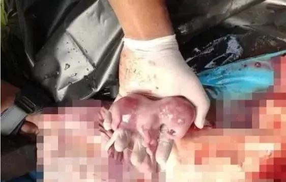 15岁怀孕，她被骗吃下*药炸**，一尸两命：有些人，这辈子不配为人