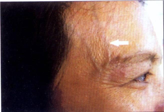 脚麻和手抖是中风的征兆吗,脚麻手麻脑子麻是什么病的前兆