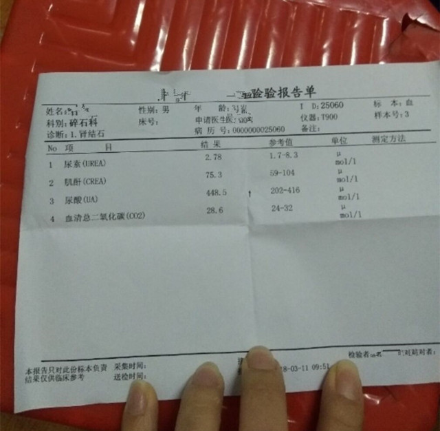 体外冲击波碎石术后肌酐升高，中药合理治疗后，肌酐戏剧性下降了