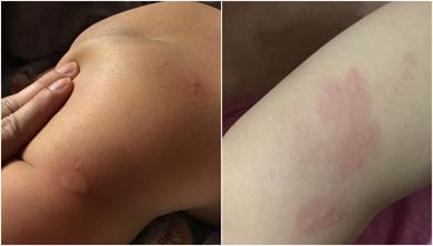 孕期注意什么防止宝宝将来过敏,孕期不注意婴儿容易得什么病