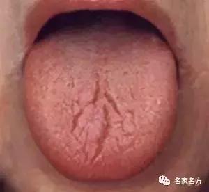 舌头是人体自带的体检表，一旦出现这个信号，马上去医院