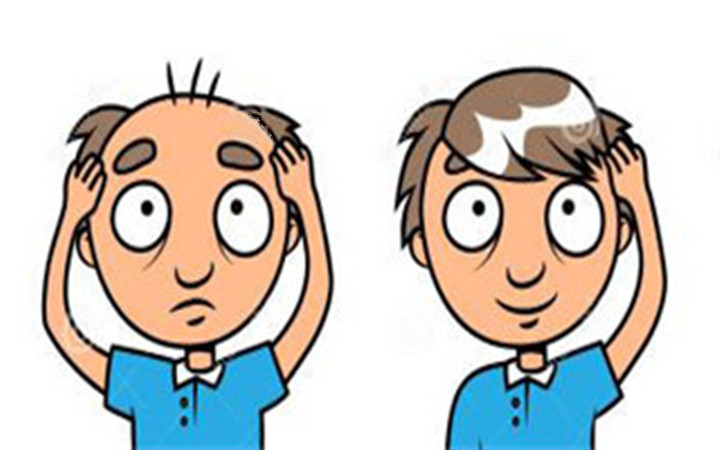 种头发到底有没有效果,种头发有用吗要多少钱