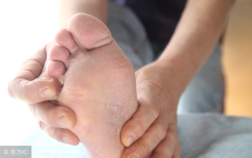 「1药说」抗真菌药物药金达克宁不能这么用