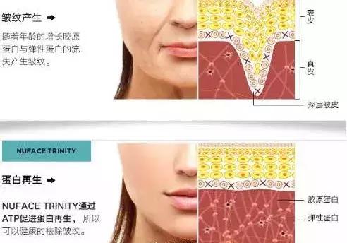 范冰冰用的哪款美容仪,如何看待范冰冰的自创美容仪品牌