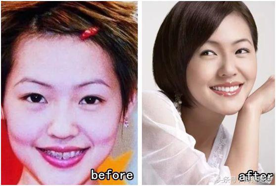 从3分到10分中间需要几分钟,从3分到4分付出了多大努力