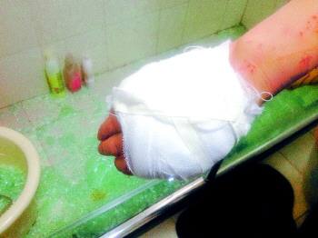 玻璃渣扎进心脏,玻璃渣子扎进血管多久会死