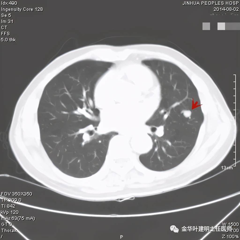 误诊报告图片,误诊案例及案例分析