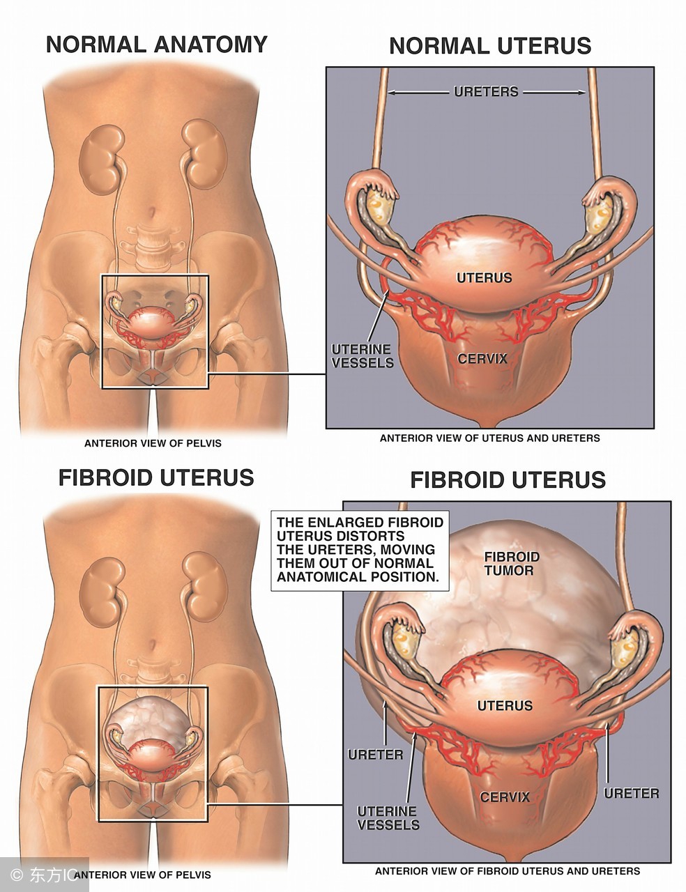 宫颈炎症状有哪些表现怎么治疗,宫颈炎是怎么引起来的有哪些症状