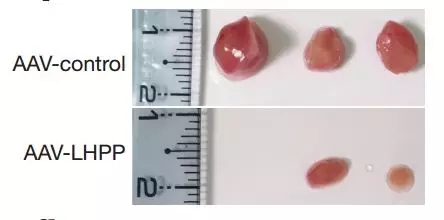肝癌大突破！拉斯克奖大牛发现全新抑癌蛋白