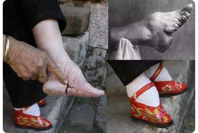中国女性缠足从哪朝开始,女性缠足始于什么朝代