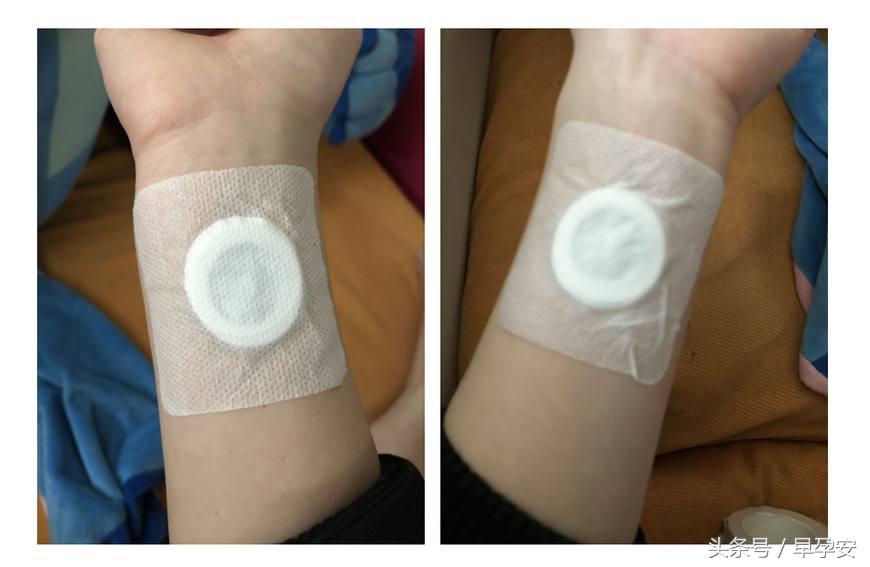 孕妇孕吐脾胃虚弱要注意什么,怀孕孕吐厉害跟肠胃有关吗