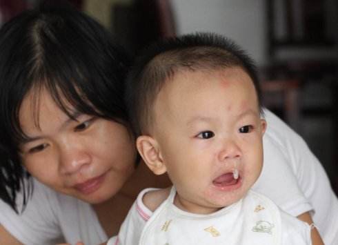 感冒鼻涕颜色代表什么,感冒鼻涕颜色代表什么症状