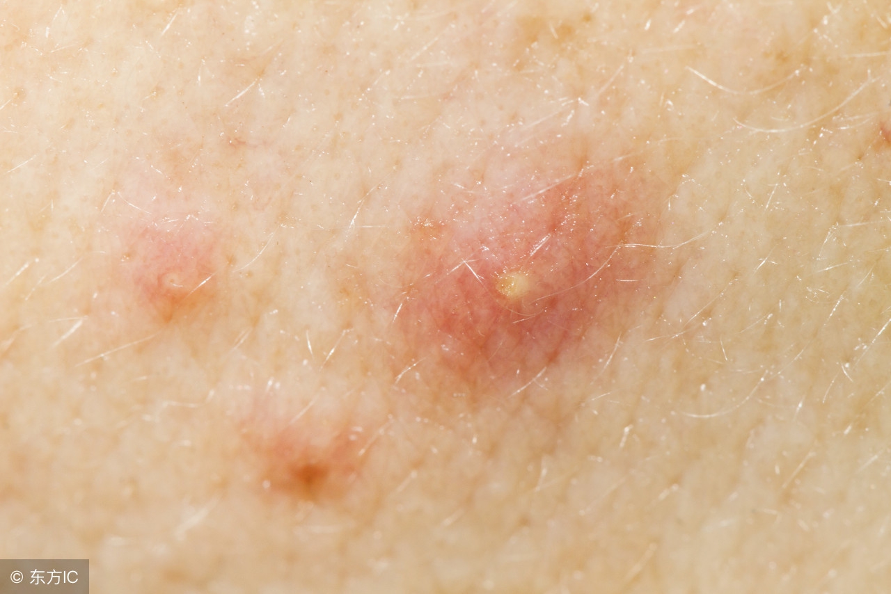 一般的硫磺皂可以洁面吗,硫磺洗脸皂和普通的硫磺皂区别