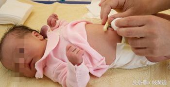 婴儿的肚脐处膨出一个圆球,宝宝肚脐眼突出一个小肉球