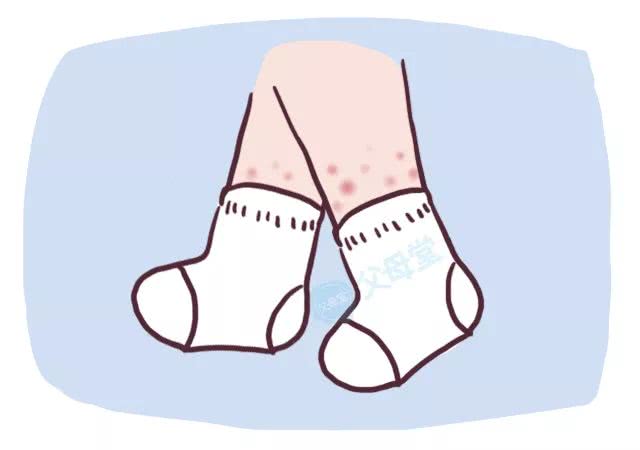 春季预防哪种虫子叮咬,怎么防止虫咬最好方法