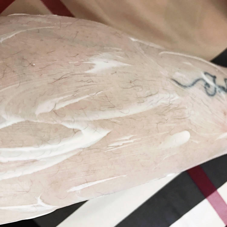 最好用最不伤皮肤的脱毛膏,最好用的脱毛膏推荐还便宜