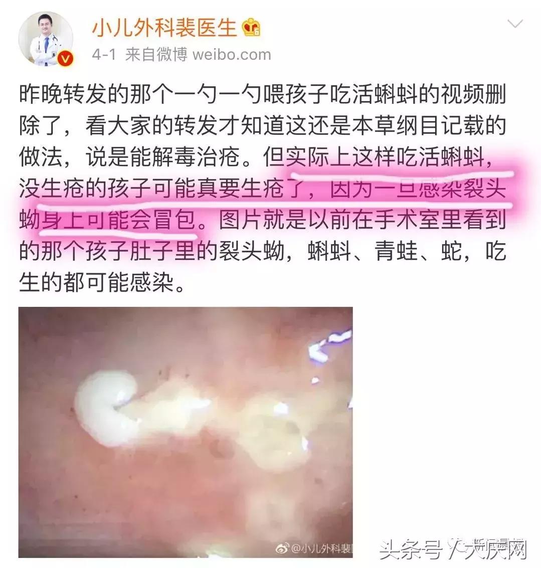 家长给幼童喂蝌蚪,家长给儿童喂食活蝌蚪