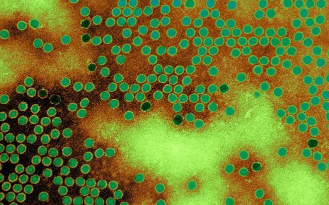 脊髓灰质炎：病毒一旦入侵神经系统就可在几小时内造成永久瘫痪