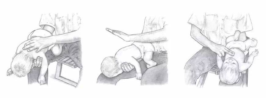 6岁男童误食火碱,男孩误食火碱险丧命