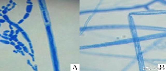 ivd基础知识大全,真菌检测要点