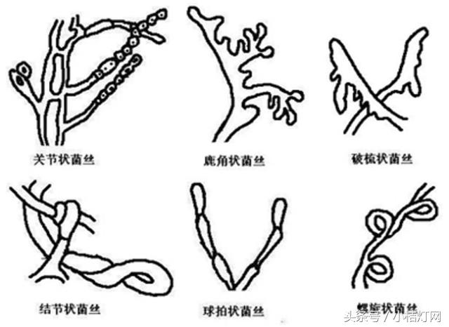 ivd基础知识大全,真菌检测要点