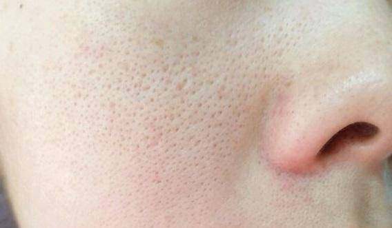 毛孔很大怎么化妆,脸上有毛孔怎么化妆好看