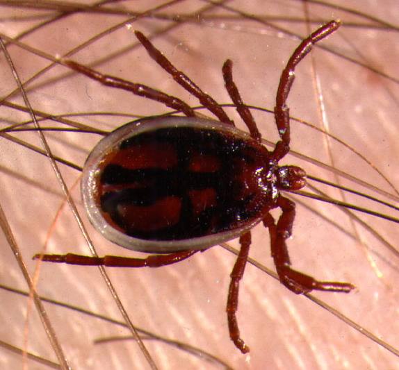 小孩头上有个包一摸会动的,小孩头上的包会动