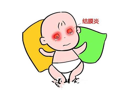 角膜炎结膜炎致眼流泪,角膜炎结膜炎眼部充血用什么药