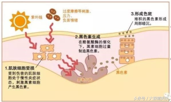 雀斑晒斑淡斑测评,雀斑晒斑淡斑又美白效果好到爆