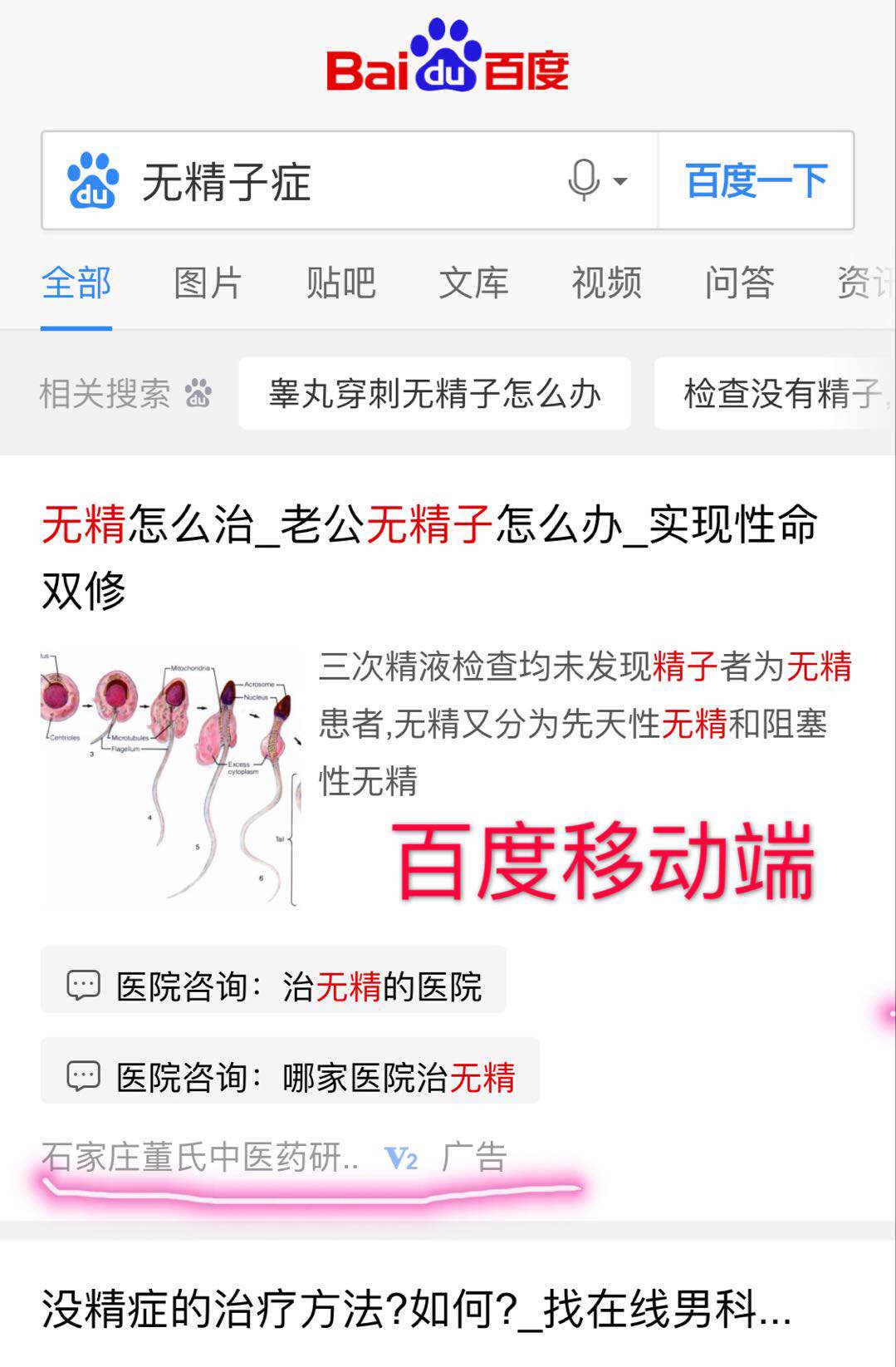 百度医疗竞价排名，我们唾弃你的坟墓