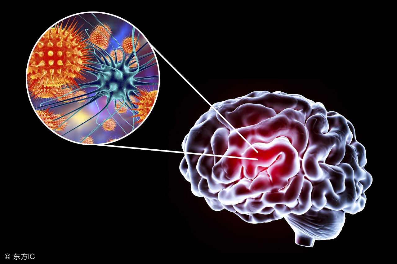 化脓性脑炎是突然发生的吗,新生儿化脓性脑炎能治好吗