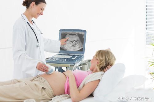 做完四维还需要做胎儿心脏检查吗,做完四维还有必要做大排畸吗