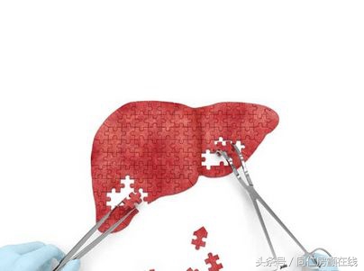 “肝功能不全”房颤患者应用口服抗凝药物注意事项