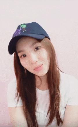 阿娇整牙,阿娇整牙前后对比