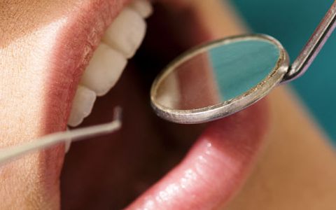 槟榔的危害口腔癌患者早期,食用槟榔导致口腔癌现状