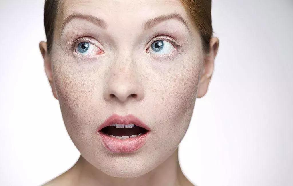 深种｜美白淡斑其实是最难的，难在专一