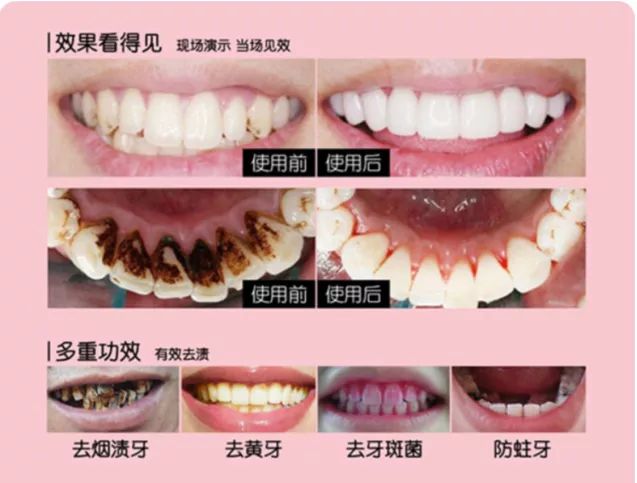 闭着嘴巴一会就干有异味,闭着嘴巴都感觉口腔有异味