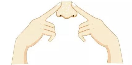 肚脐眼里抠出来粘稠的白色物质,肚脐眼里的泥用镊子取出