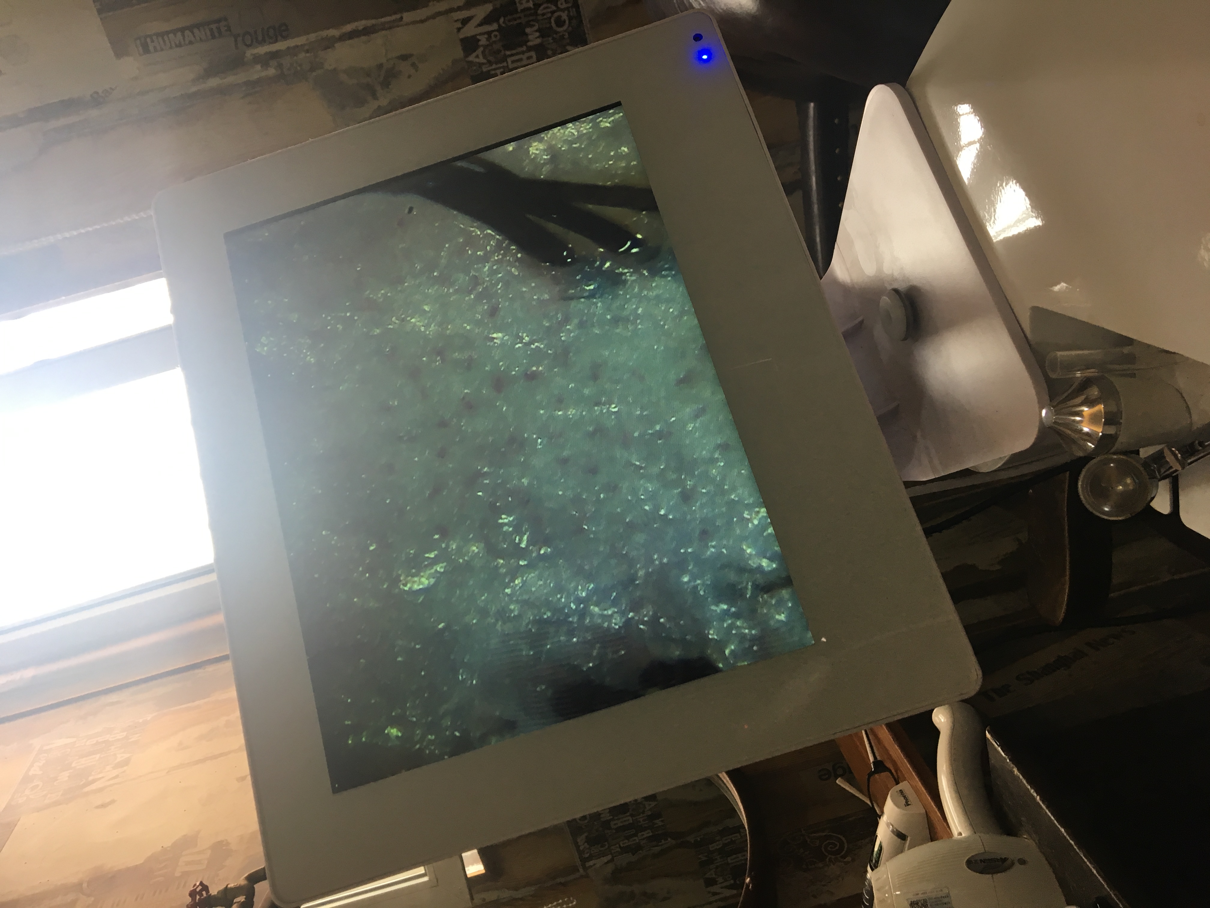 理发店头皮检测要钱吗,美发店的头皮检测去角质靠谱吗