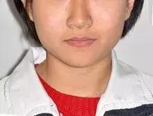 矫正牙齿可以变美吗,矫正牙齿后变美更自信