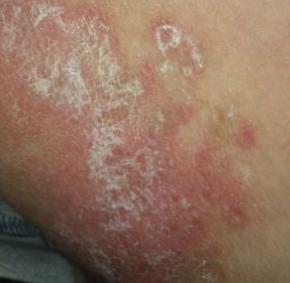 洁尔阴男士用有什么副作用吗,洁尔阴洗剂的另类用法