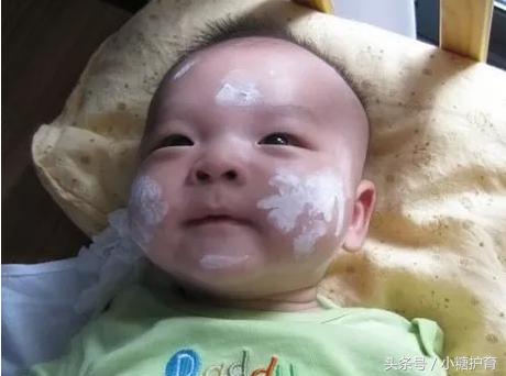 小孩皮肤红肿瘙痒是什么原因,小孩身体出现红肿并痒是怎么回事