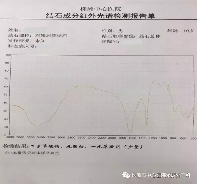 突破！无管化微创经皮肾镜取石术治疗儿童泌尿系结石