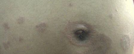 拒绝做个黄脸婆孕妇！孕产肌肤护理技巧看这里就够了