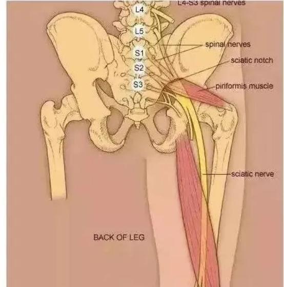 坐骨结节与坐骨神经解剖,坐骨神经结节痛治疗最好的方法